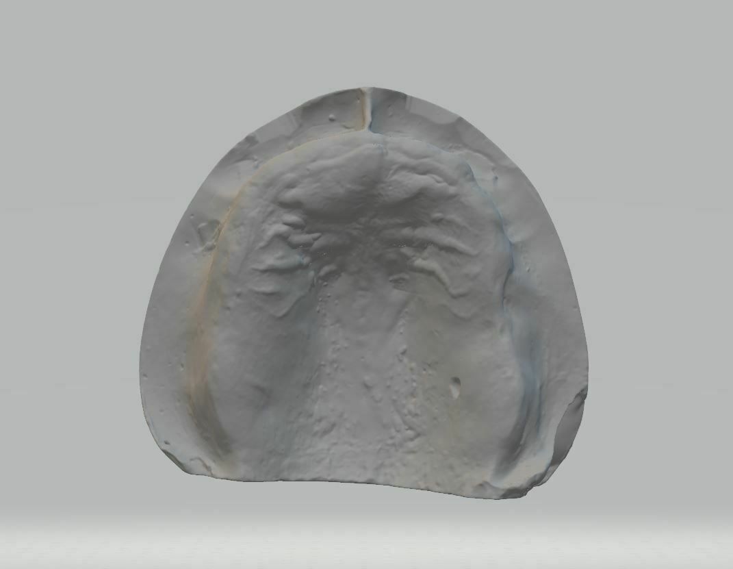 STL file Totally edentulous maxillary model 🦷・3D printable model to ...