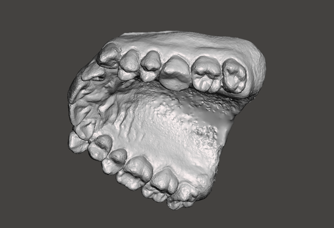 STL file Upper teeth scan. Disalignment.・3D printing design to download・Cults