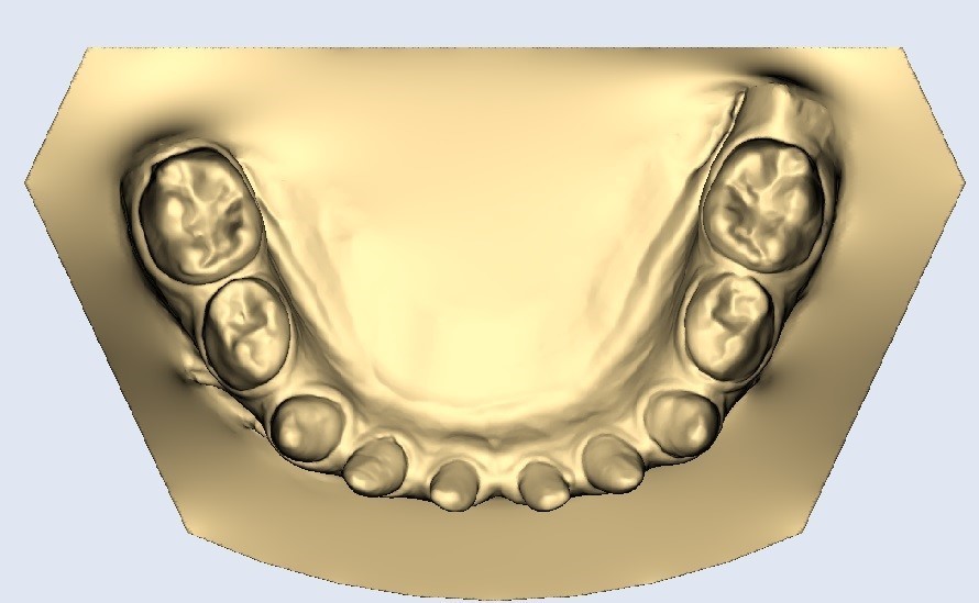 Stl File Dental Models・3d Print Design To Download vrogue.co