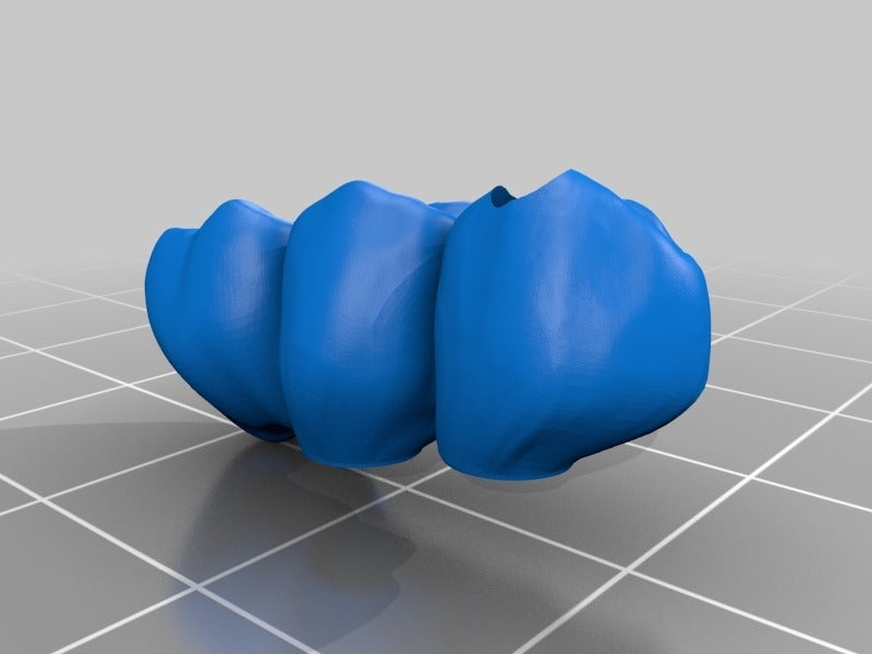STL file dental bridges on implants・3D printer design to download・Cults