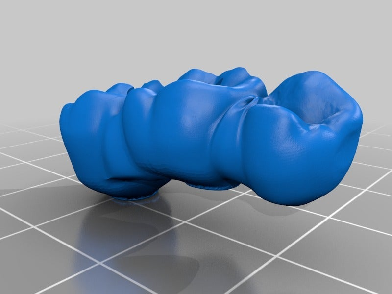 STL file dental bridges on implants・3D printer design to download・Cults