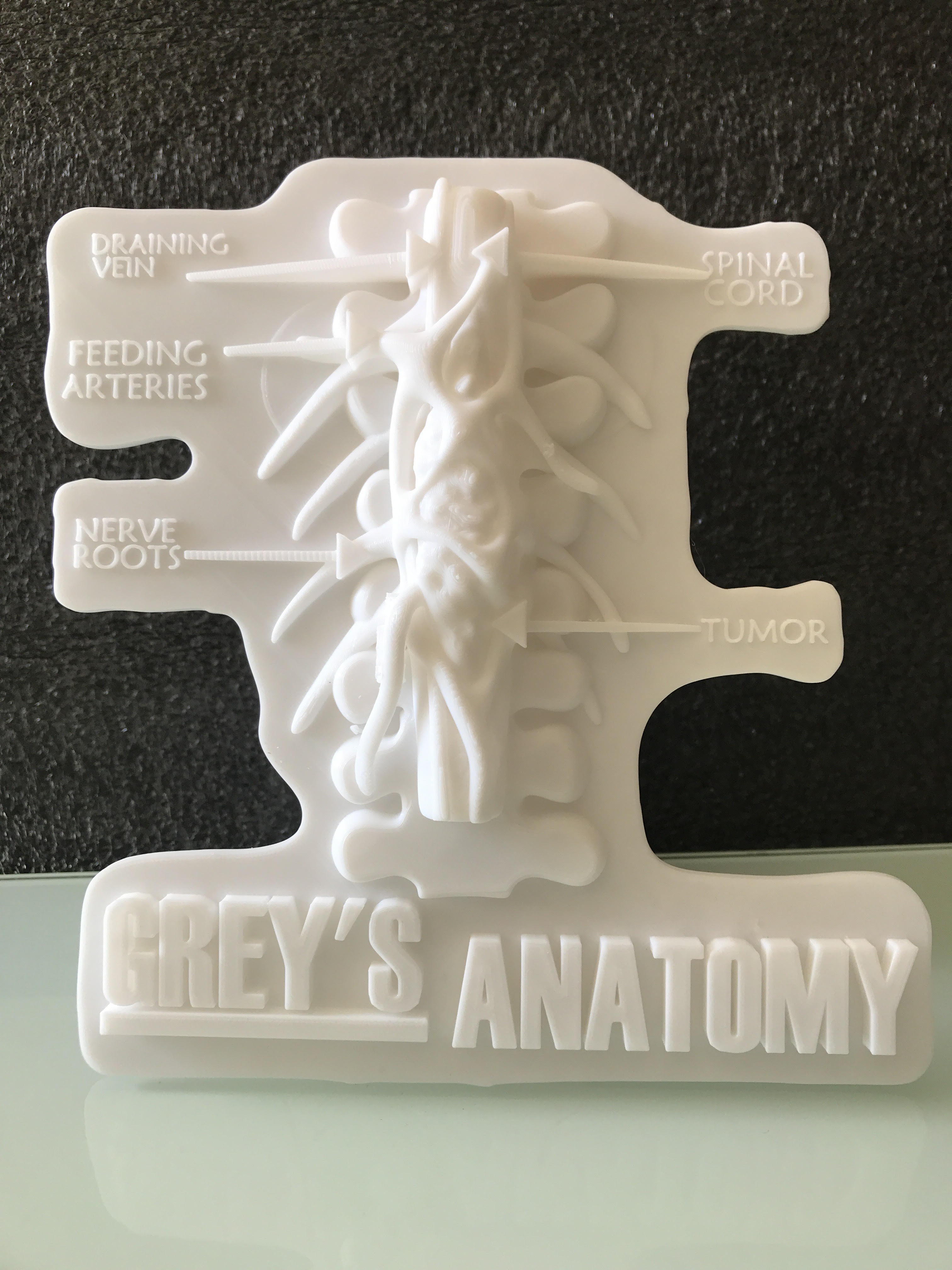 OBJ file Greys Anatomy Tumor・3D printable model to download・Cults