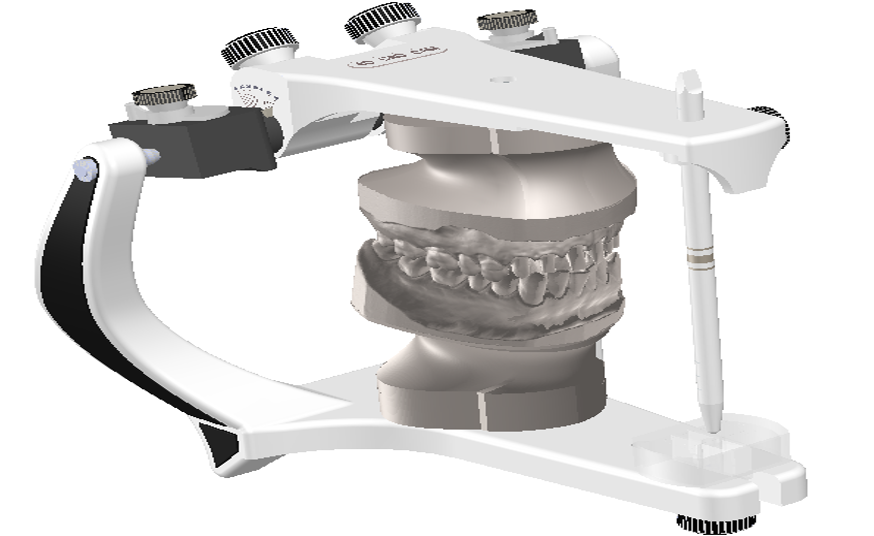 STL file BioArt Dental Articulator 🔧・3D printer model to download・Cults
