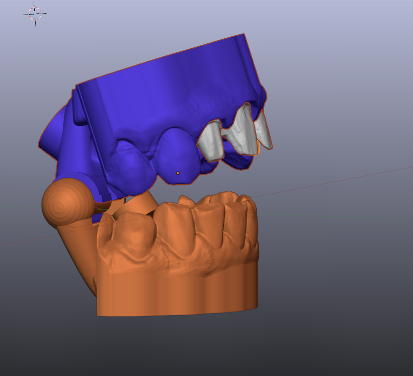 STL file Dental Models DIES and HINGE articulator B4D・3D print object
