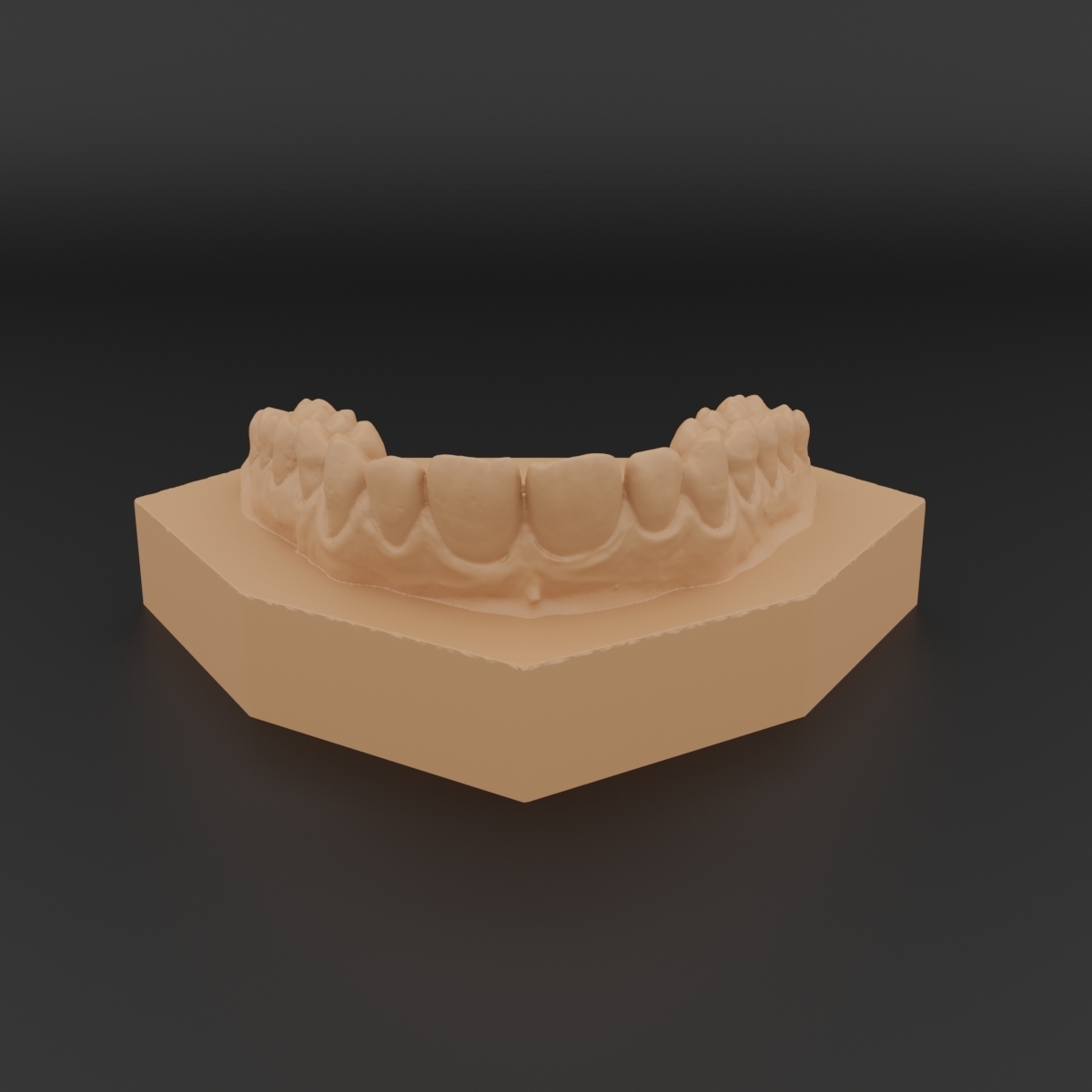 STL file Dental Orthodontic Study Model with Bases 🧑‍🏫・3D printing idea