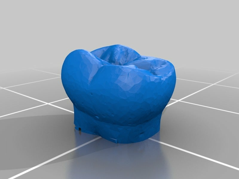 Free STL file dental partial dentures・3D printable design to download・Cults