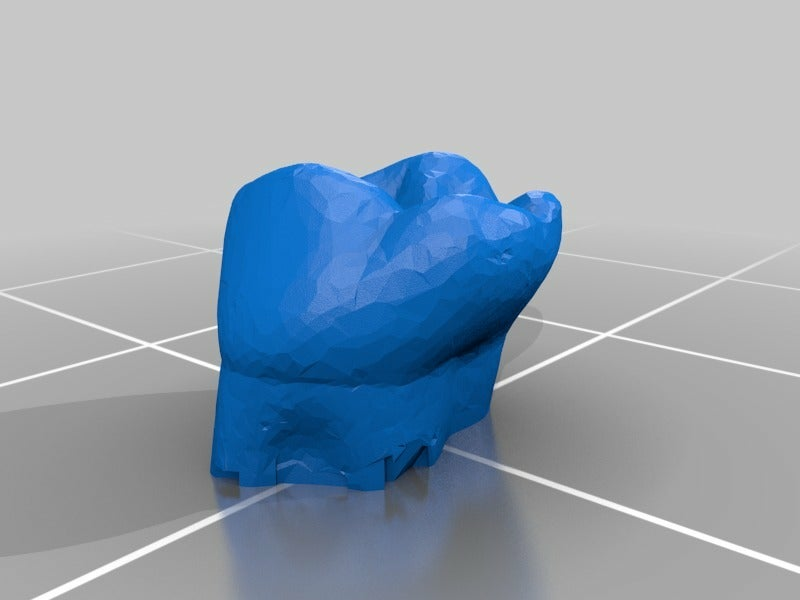 Free STL file dental partial dentures・3D printable design to download・Cults