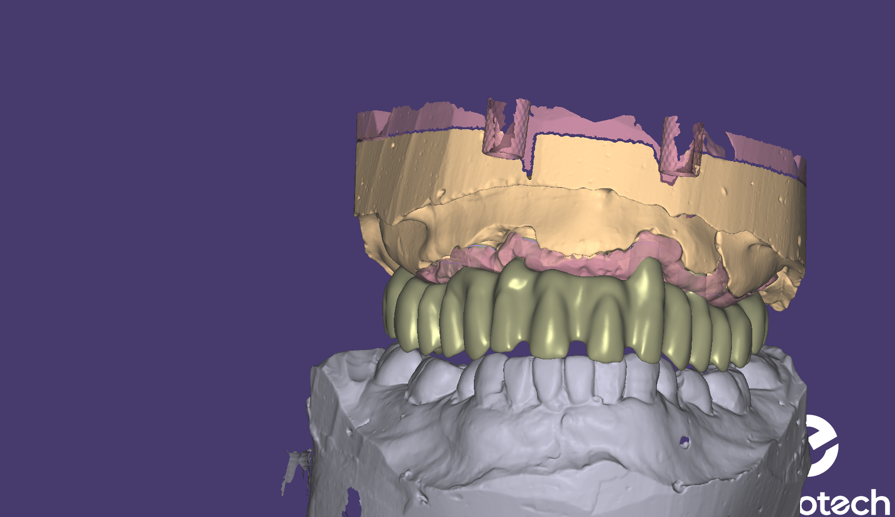 STL file Dental arch Cad-Cam・3D print model to download・Cults