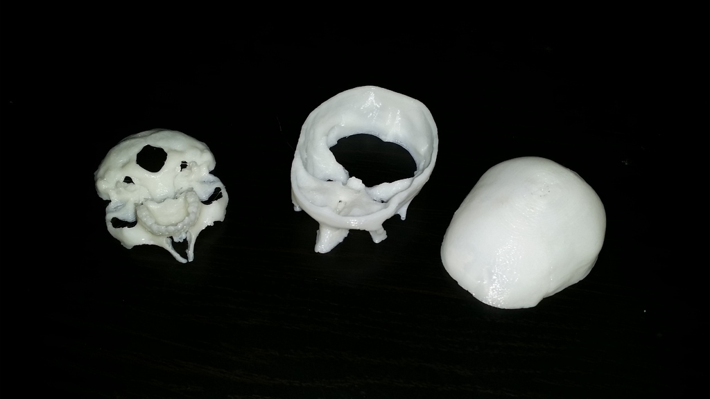 Free 3D file Human skull, anatomically correct and printer friendly